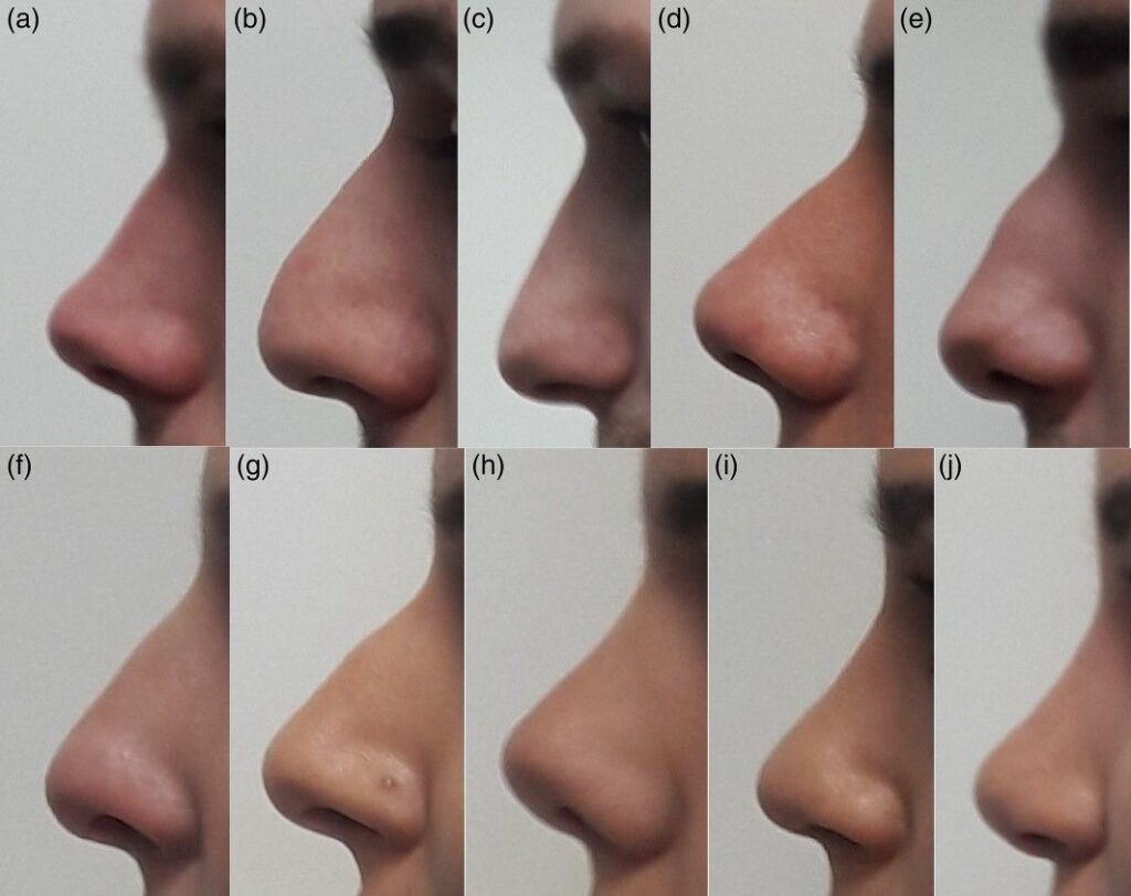 Profile views of ten different human noses showcasing variations in shape and size. Images labeled (a) to (j).