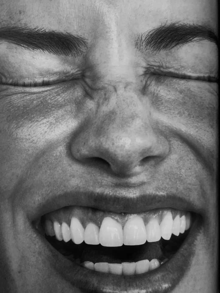 Close-up of a joyful face with eyes closed and a wide, expressive smile, showing healthy teeth. Black and white photo.