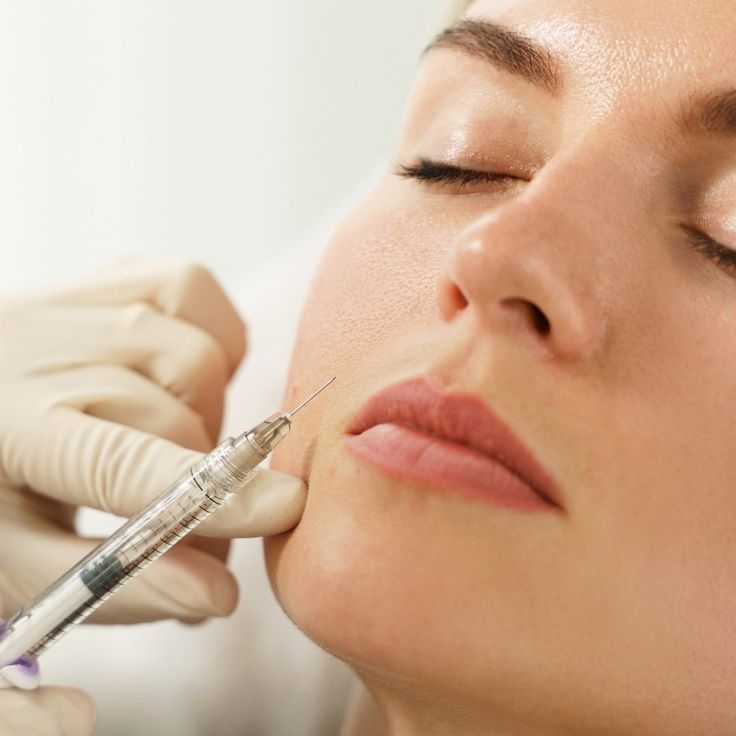 Close-up of a woman receiving a cosmetic injection in her face, enhancing skin appearance, by a professional.