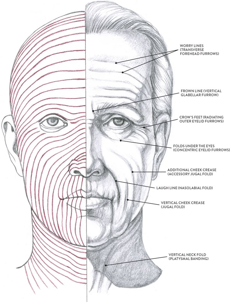 Illustration of facial wrinkles and lines: worry lines, frown lines, crow's feet, laugh lines, cheek and neck folds.