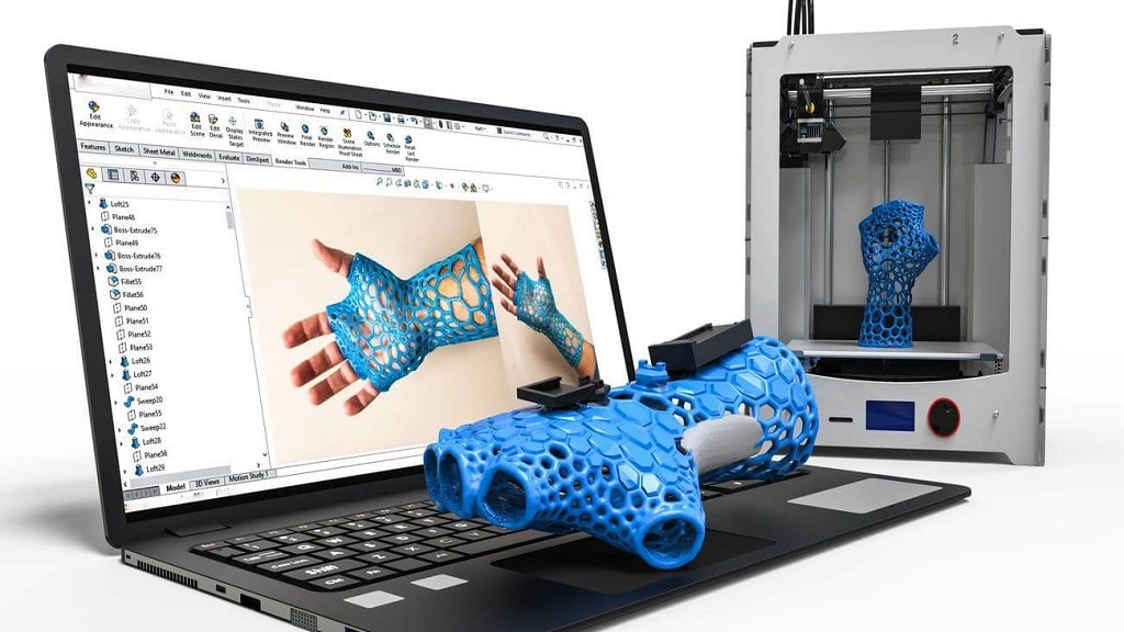 3D-printed blue cast designed on a laptop CAD software, displayed with a 3D printer in the background.