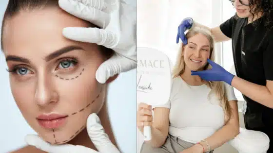 Viewing-Deck-Blog-_2_ Woman considering cosmetic procedure with surgeon marking face; another woman consults in clinic, holding mirror, receiving advice from professional. | Sky Rye Design Woman considering cosmetic procedure with surgeon marking face; another woman consults in clinic, holding mirror, receiving advice from professional.