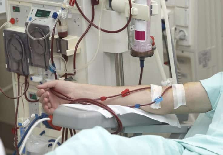 Diabetic nephropathy_ Symptoms stages causes and treatment Patient undergoing dialysis treatment in hospital, connected to machine for blood filtration and purification. | Sky Rye Design Patient undergoing dialysis treatment in hospital, connected to machine for blood filtration and purification.