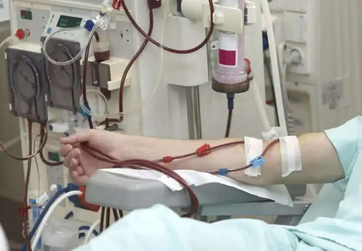 Patient undergoing dialysis treatment in hospital, connected to machine for blood filtration and purification.